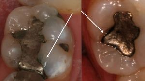 Leaky filling examples